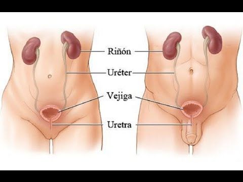 infecciones en vías urinarias 